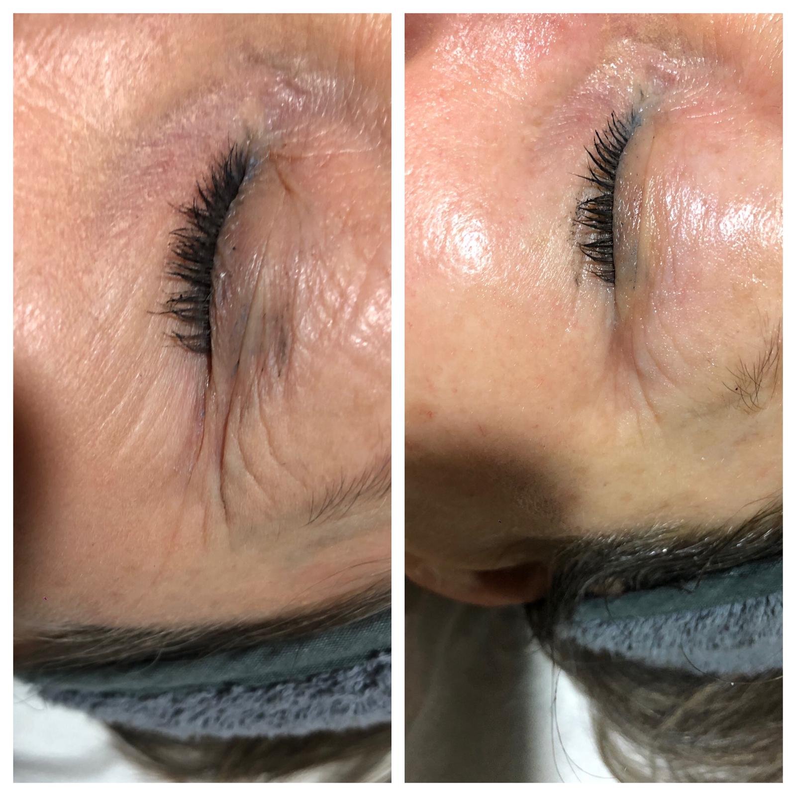 MASCARILLA DE OJOS EPIGENÉTICA